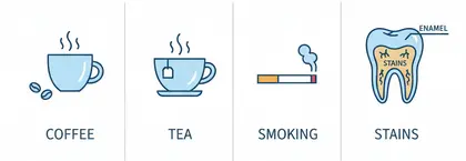 why teeth whitening kits use process matter