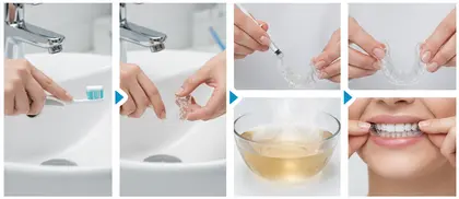 how to use teeth whitening kit at home